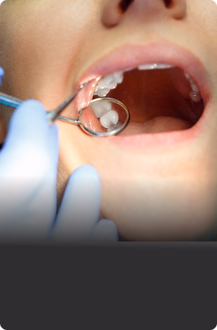 A dentist with blue gloves examines a patient's teeth using a dental mirror. The patient’s mouth is open, showing clean, white teeth. The mood is clinical.