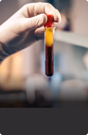 A gloved hand holds a test tube with separated blood components: red at the bottom and yellow plasma on top, set against a blurred lab background.