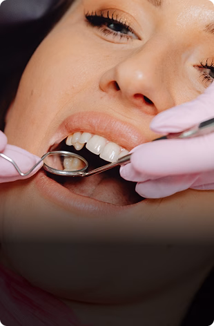 A dentist examines a patient's teeth using a dental mirror and probe. The patient wears a relaxed expression. Dentist's gloved hands are visible.